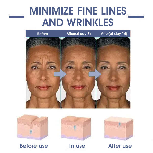 🌸LOVILDS™ 𝐀𝐝𝐯𝐚𝐧𝐜𝐞𝐝 𝐅𝐢𝐫𝐦𝐢𝐧𝐠 & 𝐖𝐫𝐢𝐧𝐤𝐥𝐞-𝐑𝐞𝐝𝐮𝐜𝐢𝐧𝐠 𝐂𝐫𝐞𝐚𝐦 Pro