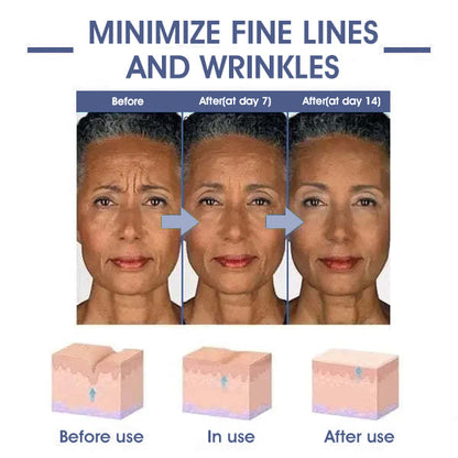 🌸LOVILDS™ 𝐀𝐝𝐯𝐚𝐧𝐜𝐞𝐝 𝐅𝐢𝐫𝐦𝐢𝐧𝐠 & 𝐖𝐫𝐢𝐧𝐤𝐥𝐞-𝐑𝐞𝐝𝐮𝐜𝐢𝐧𝐠 𝐂𝐫𝐞𝐚𝐦 Pro