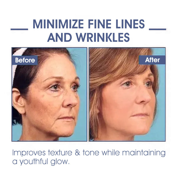 🌸LOVILDS™ 𝐀𝐝𝐯𝐚𝐧𝐜𝐞𝐝 𝐅𝐢𝐫𝐦𝐢𝐧𝐠 & 𝐖𝐫𝐢𝐧𝐤𝐥𝐞-𝐑𝐞𝐝𝐮𝐜𝐢𝐧𝐠 𝐂𝐫𝐞𝐚𝐦 Pro
