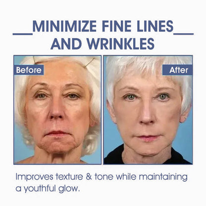 🌸LOVILDS™ 𝐀𝐝𝐯𝐚𝐧𝐜𝐞𝐝 𝐅𝐢𝐫𝐦𝐢𝐧𝐠 & 𝐖𝐫𝐢𝐧𝐤𝐥𝐞-𝐑𝐞𝐝𝐮𝐜𝐢𝐧𝐠 𝐂𝐫𝐞𝐚𝐦 Pro