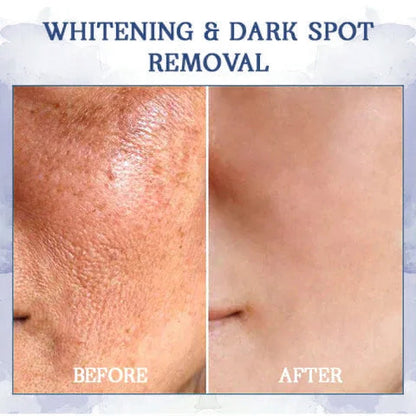🌸LOVILDS™ 𝐀𝐝𝐯𝐚𝐧𝐜𝐞𝐝 𝐅𝐢𝐫𝐦𝐢𝐧𝐠 & 𝐖𝐫𝐢𝐧𝐤𝐥𝐞-𝐑𝐞𝐝𝐮𝐜𝐢𝐧𝐠 𝐂𝐫𝐞𝐚𝐦 Pro