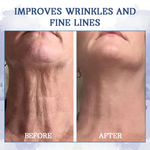 🌸LOVILDS™ 𝐀𝐝𝐯𝐚𝐧𝐜𝐞𝐝 𝐅𝐢𝐫𝐦𝐢𝐧𝐠 & 𝐖𝐫𝐢𝐧𝐤𝐥𝐞-𝐑𝐞𝐝𝐮𝐜𝐢𝐧𝐠 𝐂𝐫𝐞𝐚𝐦 Pro