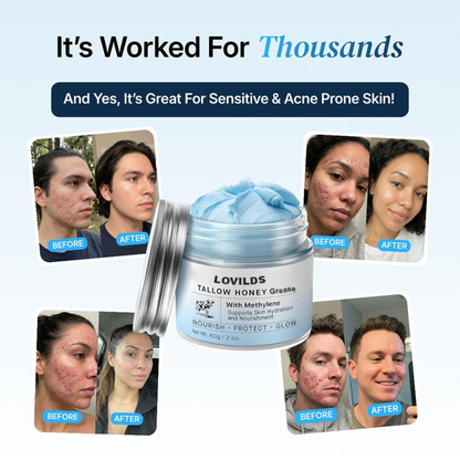 ✨🩵𝐋𝐚𝐬𝐭 𝐃𝐚𝐲 𝐃𝐢𝐬𝐜𝐨𝐮𝐧𝐭: 50% 𝐎𝐅𝐅🌸LOVILDS™ Tallow Honey Grease with Methylene - Naturally Hydrates to Restore Balance and Prevent Aging